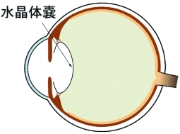 後発白内障とその治療 医学小知識