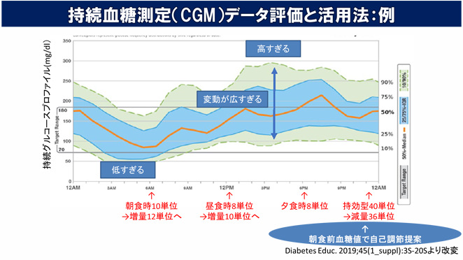 持続血糖測定（CGM）データ評価と活用法:例